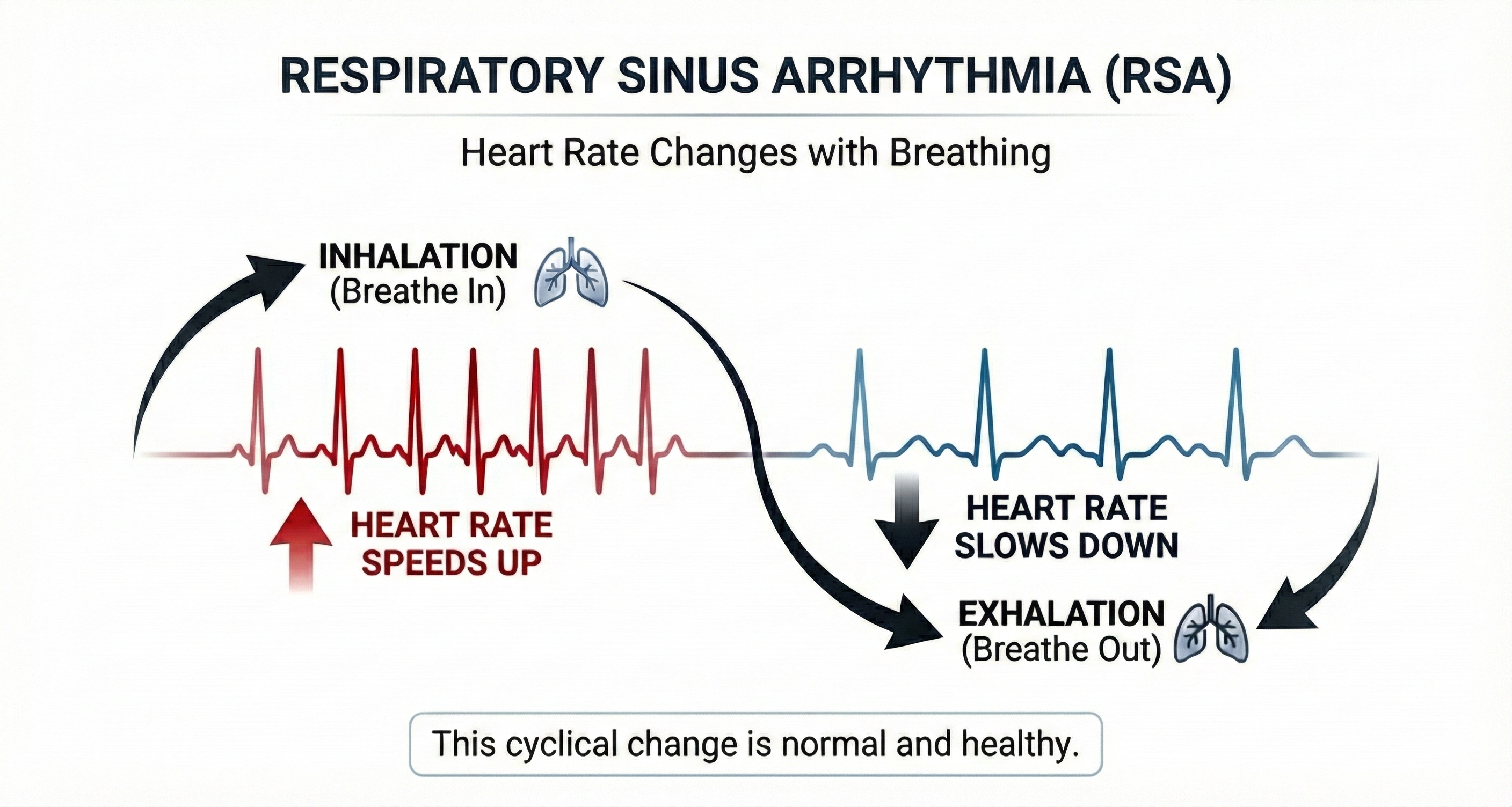 Respiratory sinus arrhythmia